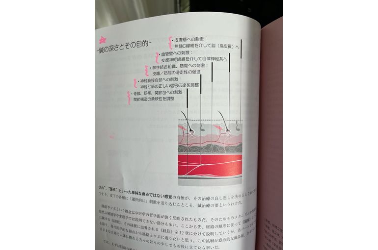 鍼灸の写真